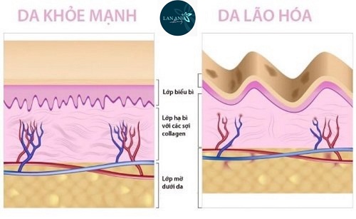 Biện pháp dễ thực hiện giúp làm chậm lão hóa da